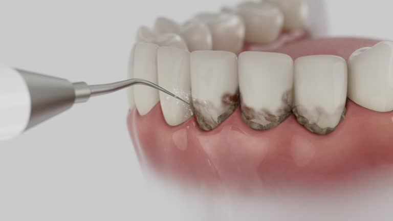 Reliable Dental Implants contractor in Jerome, ID by Smile Center Dentistry